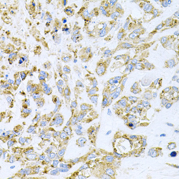 HDAC3 Antibody in Immunohistochemistry (Paraffin) (IHC (P))