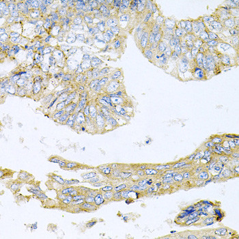 HDAC3 Antibody in Immunohistochemistry (Paraffin) (IHC (P))