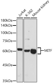 MiTF Antibody in Western Blot (WB)