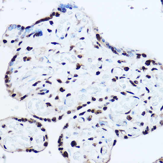 SAFB2 Antibody in Immunohistochemistry (Paraffin) (IHC (P))