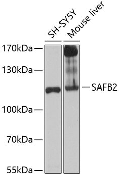 SAFB2 Antibody in Western Blot (WB)