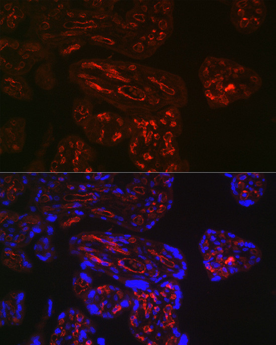 CD32b Antibody in Immunohistochemistry (Paraffin) (IHC (P))