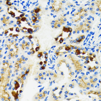 GABARAP Antibody in Immunohistochemistry (Paraffin) (IHC (P))