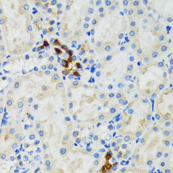 GABARAP Antibody in Immunohistochemistry (Paraffin) (IHC (P))