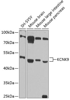 KCNK9 Antibody in Western Blot (WB)