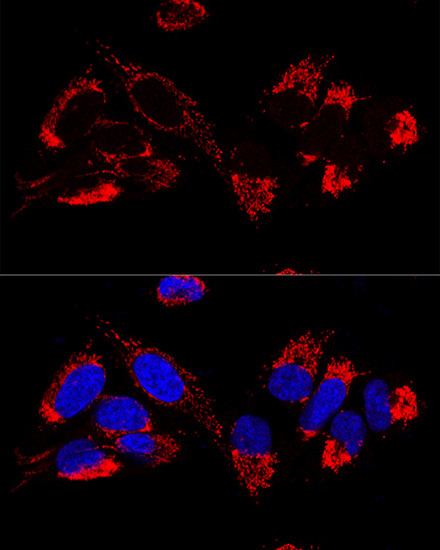 UCRC Antibody in Immunocytochemistry (ICC/IF)