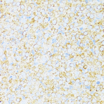 UCRC Antibody in Immunohistochemistry (Paraffin) (IHC (P))