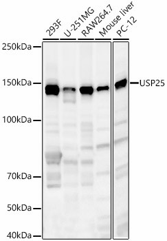 USP25 Antibody in Western Blot (WB)