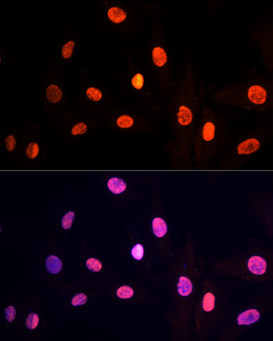 PRP19 Antibody in Immunocytochemistry (ICC/IF)