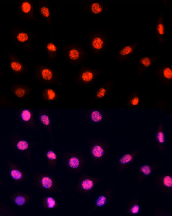 PRP19 Antibody in Immunocytochemistry (ICC/IF)