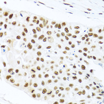 PRP19 Antibody in Immunohistochemistry (Paraffin) (IHC (P))