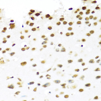 PRP19 Antibody in Immunohistochemistry (Paraffin) (IHC (P))