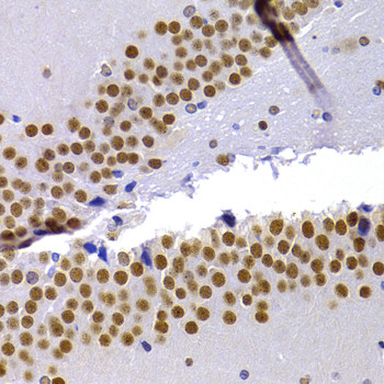 HP1 alpha Antibody in Immunohistochemistry (Paraffin) (IHC (P))