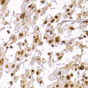 HP1 alpha Antibody in Immunohistochemistry (Paraffin) (IHC (P))