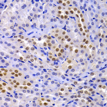 HP1 alpha Antibody in Immunohistochemistry (Paraffin) (IHC (P))