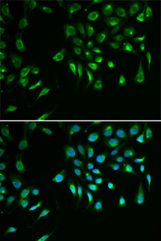 Livin Antibody in Immunocytochemistry (ICC/IF)