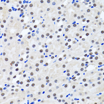 Livin Antibody in Immunohistochemistry (Paraffin) (IHC (P))