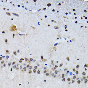 Livin Antibody in Immunohistochemistry (Paraffin) (IHC (P))