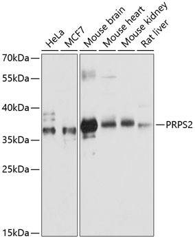 PRPS2 Antibody in Western Blot (WB)