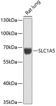 ASCT2 Antibody in Western Blot (WB)