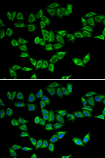 PRDX5 Antibody in Immunocytochemistry (ICC/IF)