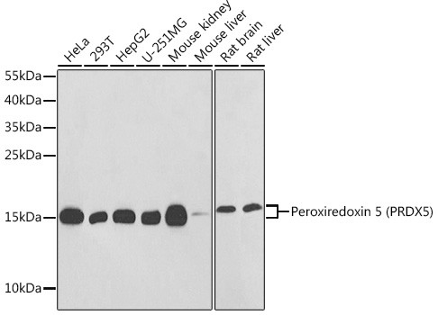 PRDX5 Antibody in Western Blot (WB)