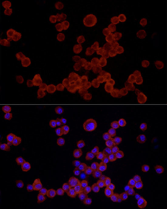 NLRP3 Antibody in Immunocytochemistry (ICC/IF)