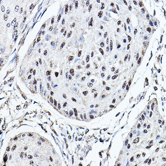 MDC1 Antibody in Immunohistochemistry (Paraffin) (IHC (P))