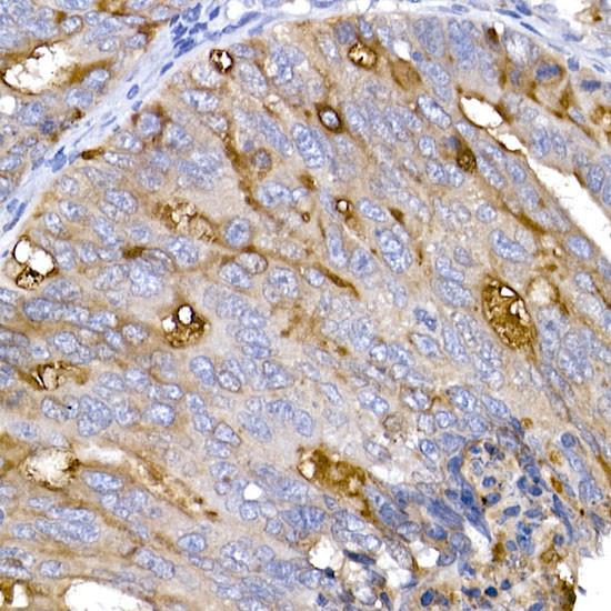 ACE2 Antibody in Immunohistochemistry (Paraffin) (IHC (P))