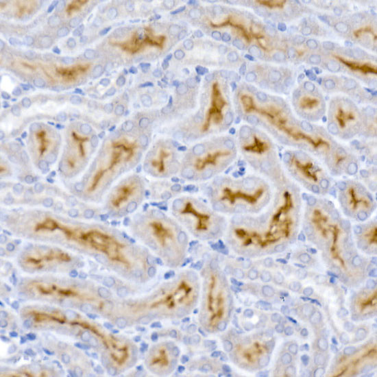 ACE2 Antibody in Immunohistochemistry (Paraffin) (IHC (P))