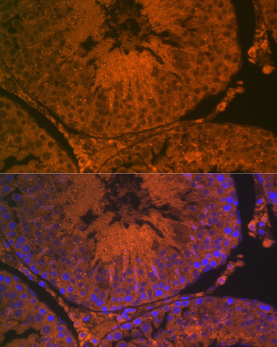 ACE2 Antibody in Immunohistochemistry (Paraffin) (IHC (P))