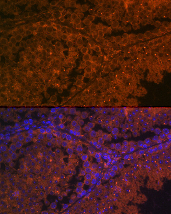 ACE2 Antibody in Immunohistochemistry (Paraffin) (IHC (P))