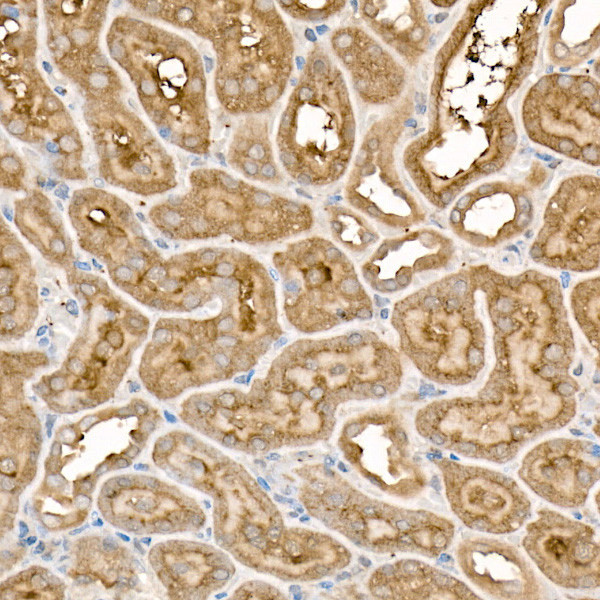 FZD5 Antibody in Immunohistochemistry (Paraffin) (IHC (P))