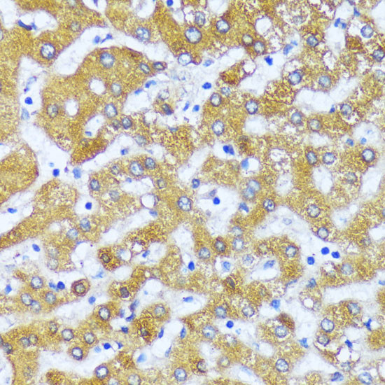 ACOX2 Antibody in Immunohistochemistry (Paraffin) (IHC (P))