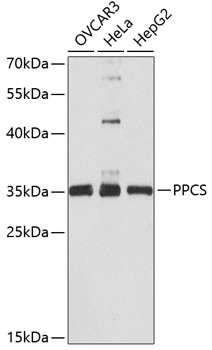 PPCS Antibody in Western Blot (WB)