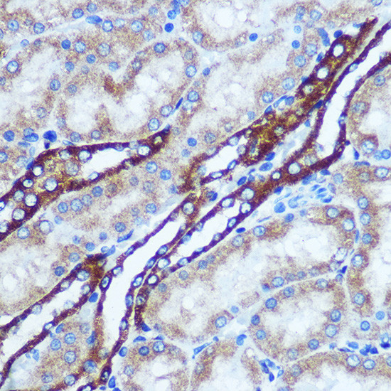 GSTT1 Antibody in Immunohistochemistry (Paraffin) (IHC (P))