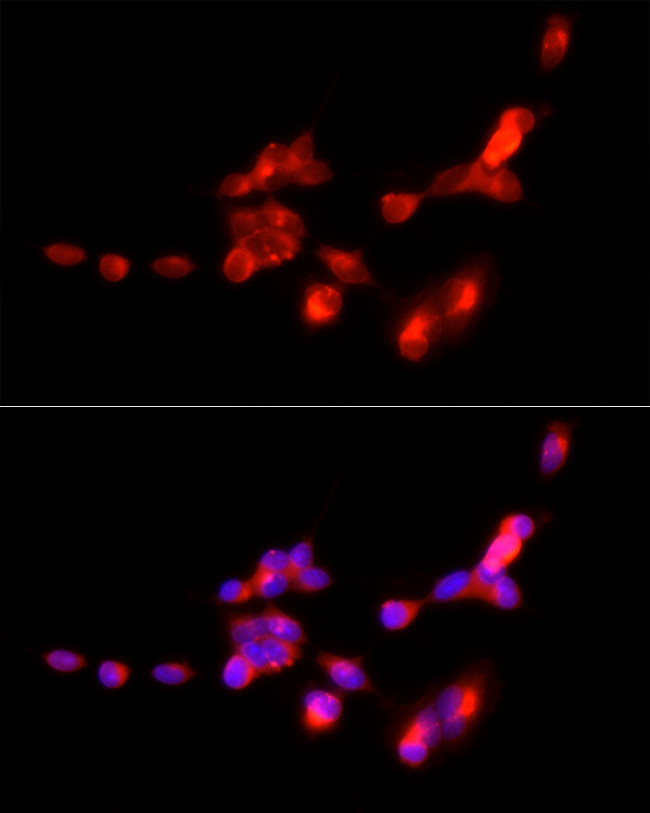 VGLUT1 Antibody in Immunocytochemistry (ICC/IF)