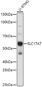 VGLUT1 Antibody in Western Blot (WB)