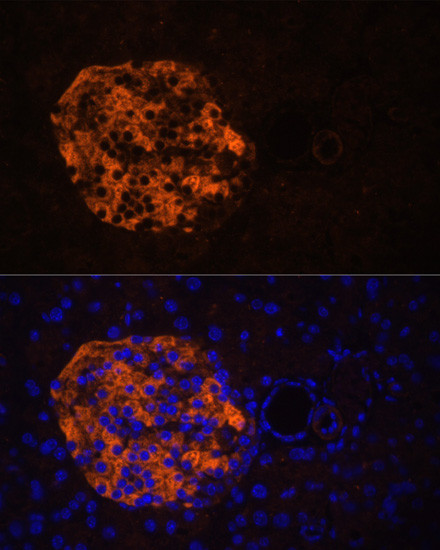 PNLIPRP2 Antibody in Immunohistochemistry (Paraffin) (IHC (P))