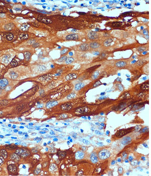 SCGN Antibody in Immunohistochemistry (Paraffin) (IHC (P))