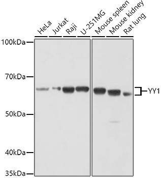 YY1 Antibody in Western Blot (WB)