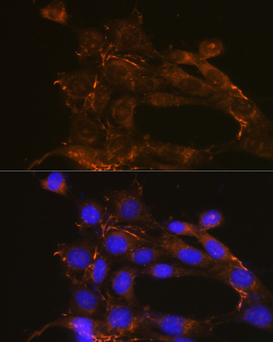 Fibronectin Antibody in Immunocytochemistry (ICC/IF)