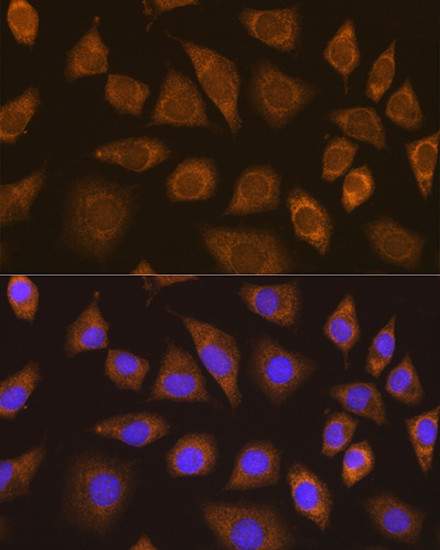 TRIM25 Antibody in Immunocytochemistry (ICC/IF)