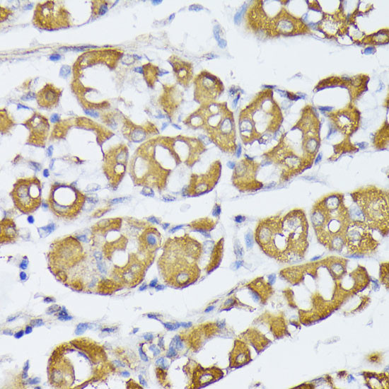 VAPA Antibody in Immunohistochemistry (Paraffin) (IHC (P))