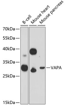 VAPA Antibody in Western Blot (WB)