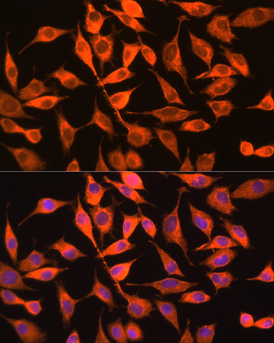 PITPN Antibody in Immunocytochemistry (ICC/IF)