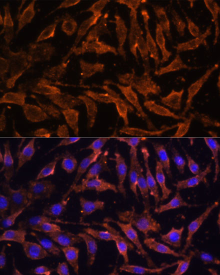 RANK Antibody in Immunocytochemistry (ICC/IF)