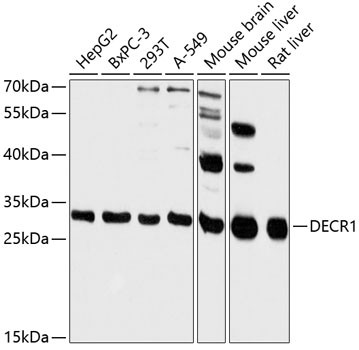 DECR1 Antibody in Western Blot (WB)