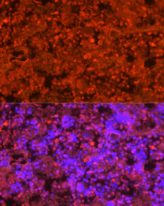 Neutrophil elastase Antibody in Immunocytochemistry (ICC/IF)