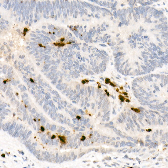 Neutrophil elastase Antibody in Immunohistochemistry (Paraffin) (IHC (P))